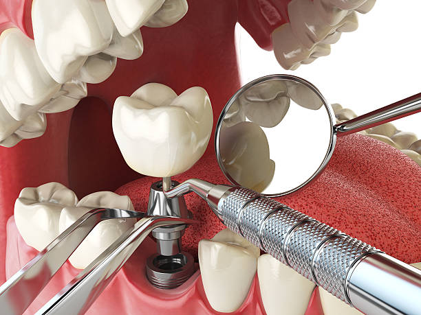 Best Emergency Treatment for Oral Infections in Strum, WI