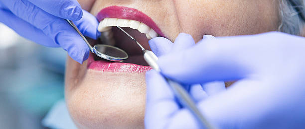 Best Broken or Chipped Tooth Repair in Strum, WI